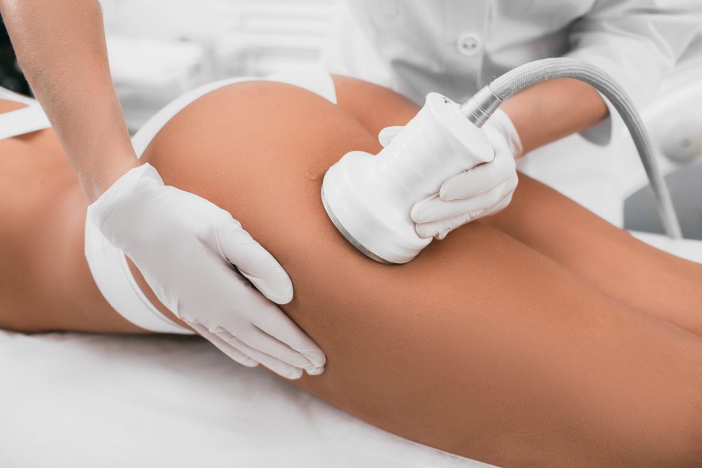 Ultrasonic cavitation body contouring at Slender Me Medical in Corona, CA